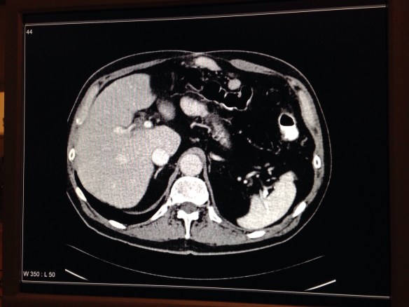 20131028-125343 a.m..jpg